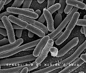  [Wikimedia](https://species.wikimedia.org/wiki/Escherichia_coli#/media/File:EscherichiaColi_NIAID.jpg) 